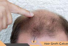 Hair Transplant Scars Prevention and Treatment Options