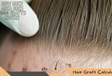 How Much Area Does 6000 Grafts Cover