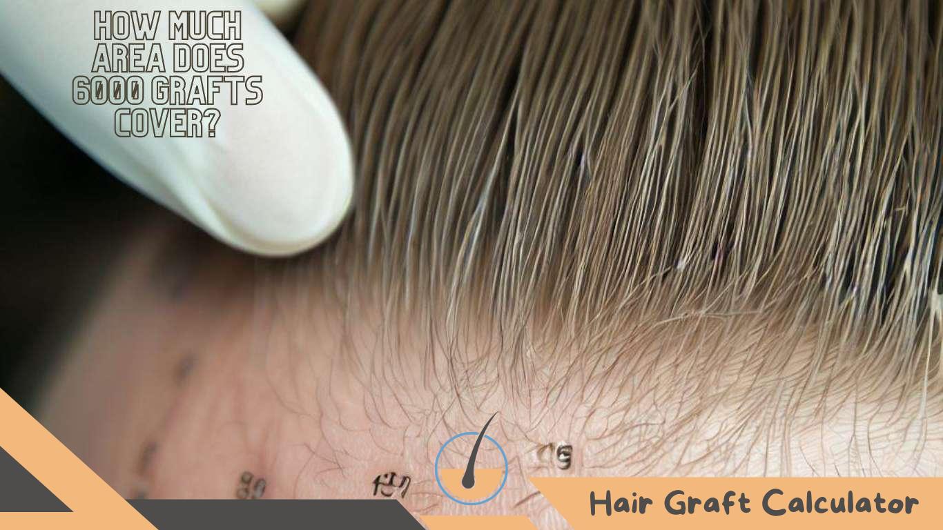 How Much Area Does 6000 Grafts Cover