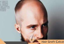 How Much Area Does 3000 Grafts Cover