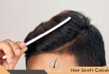 Can I Touch My Hair 1 Week After Hair Transplant